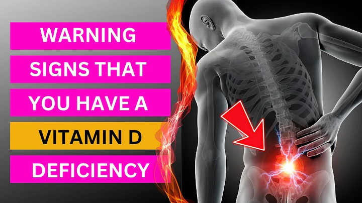 TOP 7 Warning Signs of Vitamin D Deficiency You MUST Know