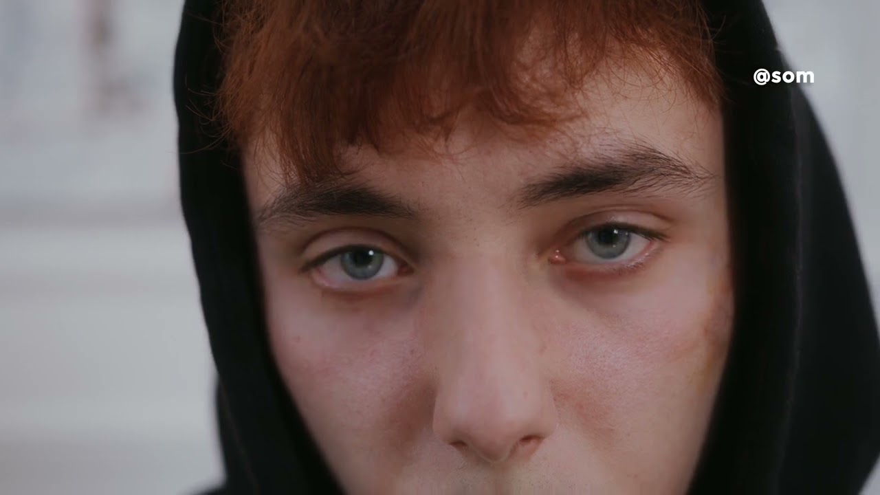 Face cleanup 2025 | VFX | NUKE | After Effects | By Swarup Ghosh