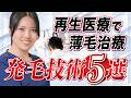 再生医療を利用した発毛技術5選
