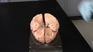 TJs Anatomy - 223 Lab 6 (Brain and Cranial Nerves)