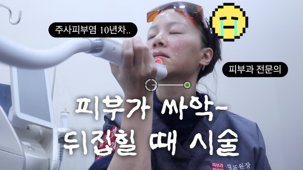 드디어 피부가 나빠진 김에...🍙