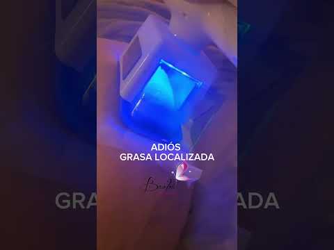 Criolipolisis, adiós grasa localizada