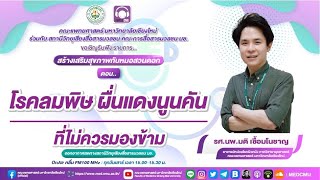 สร้างเสริมสุขภาพกับหมอสวนดอก ตอน โรคลมพิษผื่นแดงนูนคัน ที่ไม่ควรมองข้าม