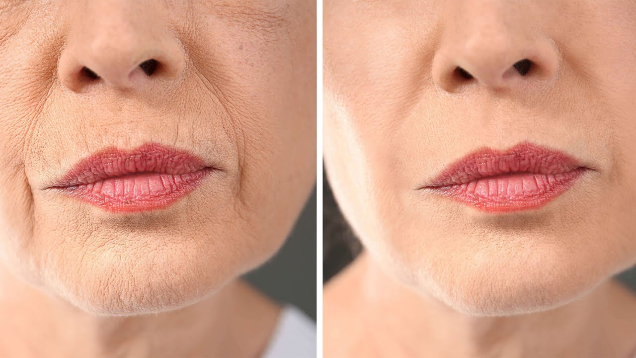 68-ամյա կնոջ գաղտնիքը․ Բնական միջոց, որը վերացնում է կնճիռները և երտասարդացնում մաշկը