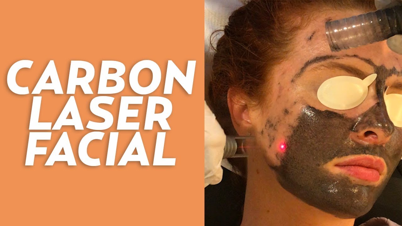 Carbon Laser Facial: My Experience at Thibiant in Beverly Hills!