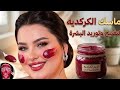 وداعا للتصبغات والهالات السوداء مع كريم الكركديه المبيض الفعال 