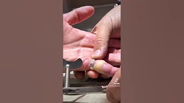 Cutting off a ring from a finger. Jewellery repair, jewelry, fix