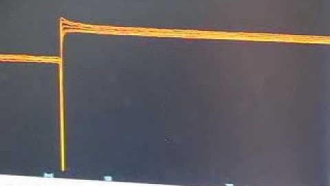 8 - Recording with an activation protocol.avi