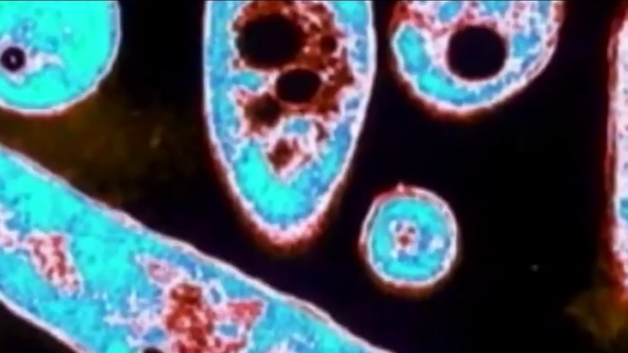 8 local cases of Legionnaires' Disease