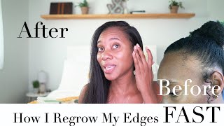 How To Regrow Edges On Natural Hair FAST