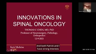 Innovations in Spinal Oncology