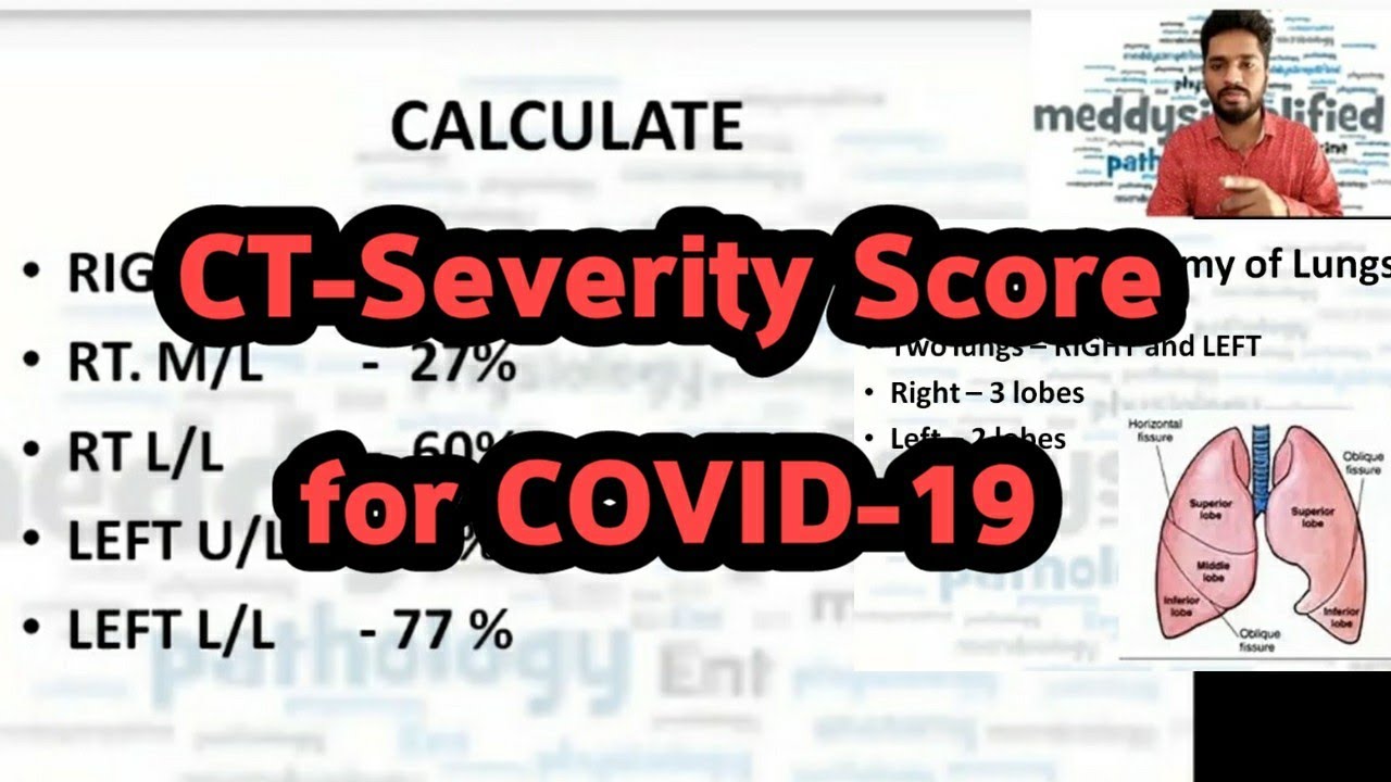 CT Severity Score for COVID-19 | CT Chest for COVID patients ...