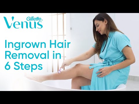 Safe Ingrown Hair Removal in 6 steps | Hair Removal At Home | Venus Gillette India