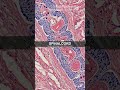 Spinalcord | Neuropathology | Microscopic - Vertical Stock Footage
