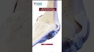 How Does the Knee Joint Move? | 3D Knee Animation | Knee Movement | Dr. Srinivas Polisetty #ortho
