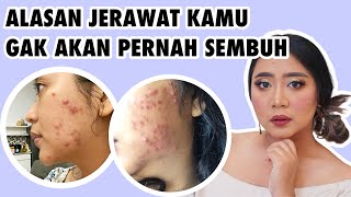 1 KESALAHAN BESAR DALAM MENYEMBUHKAN JERAWAT !!