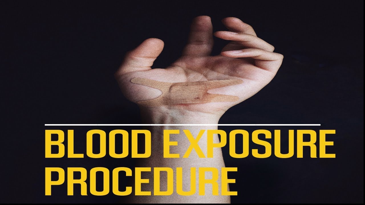 Blood Exposure Procedure YouTube