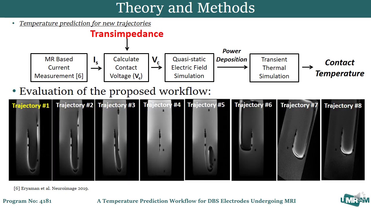A Temperature Prediction Workflow for DBS Electrodes Undergoing MRI by Alireza Sadeghi Tarakameh