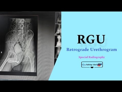 Retrograde Urethrogram Radiograph RGU (Retrograde Urethrogram) image // RGU Procedure - YouTube
