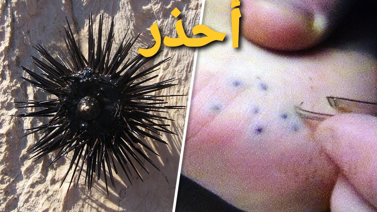 حداري من هاد كائن متشوك 😡