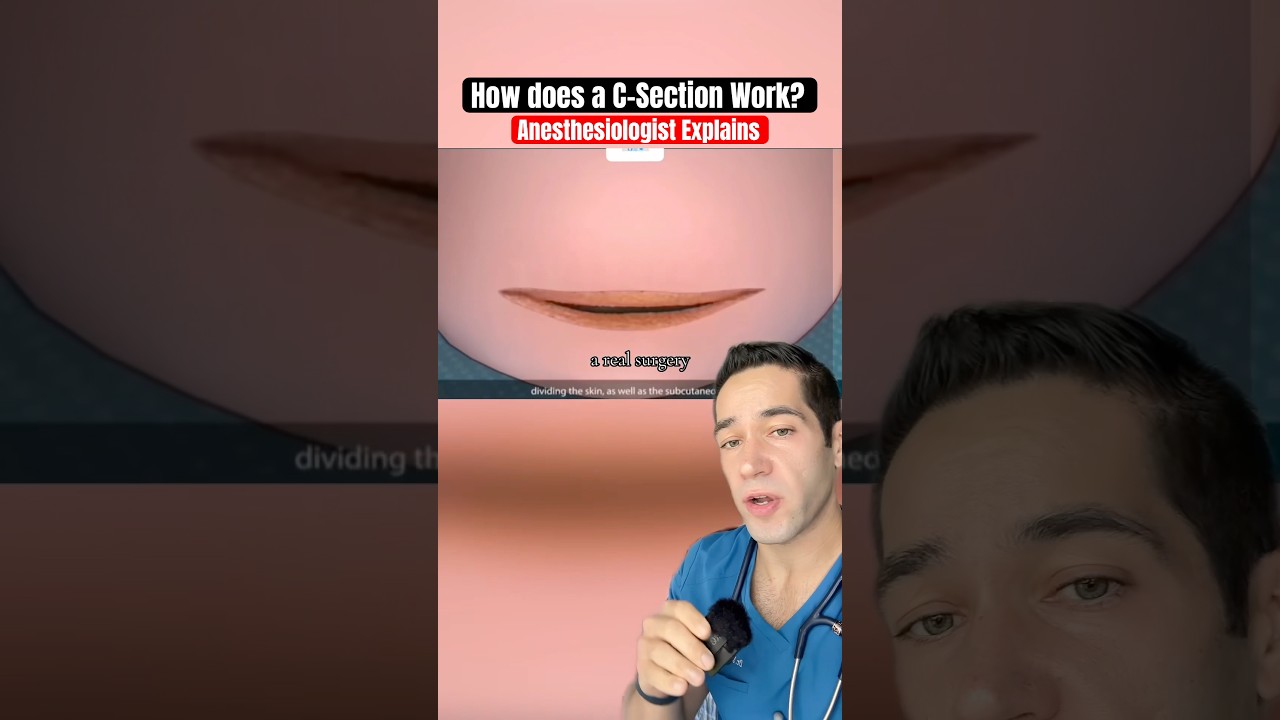 How do C-Sections REALLY work?