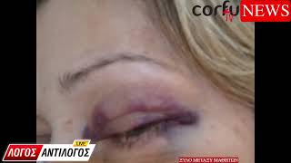 Ξύλο μεταξύ μαθητών στην Λευκάδα ...