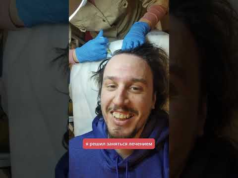 Видео: Действа ли derma rolling при косопад?