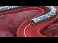 Neurovascular access catheter 3d animation  infuse medical