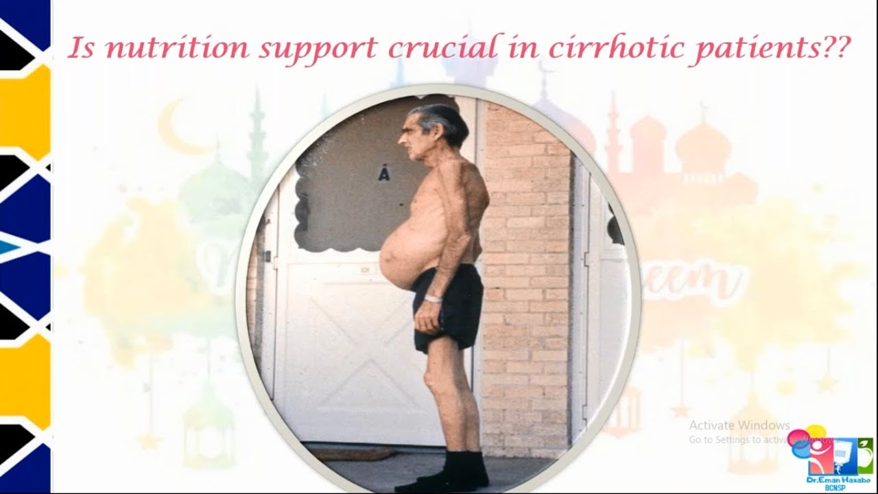 Nutritional challenges in cirrhotic patients in Ramadan.