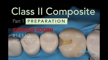 Class II MO Composite Preparation with Caries #14 Acadental | Part 1