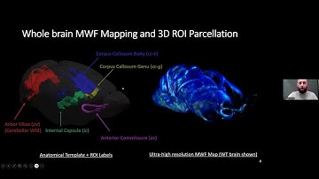 Vladimir Grouza - Histological Validation of rPCA Myelin Water Fraction in Hypomyelinating Mice
