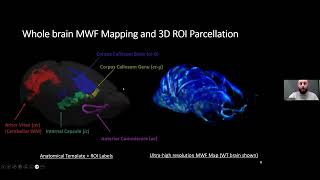 Vladimir Grouza - Histological Validation of rPCA Myelin Water Fraction in Hypomyelinating Mice