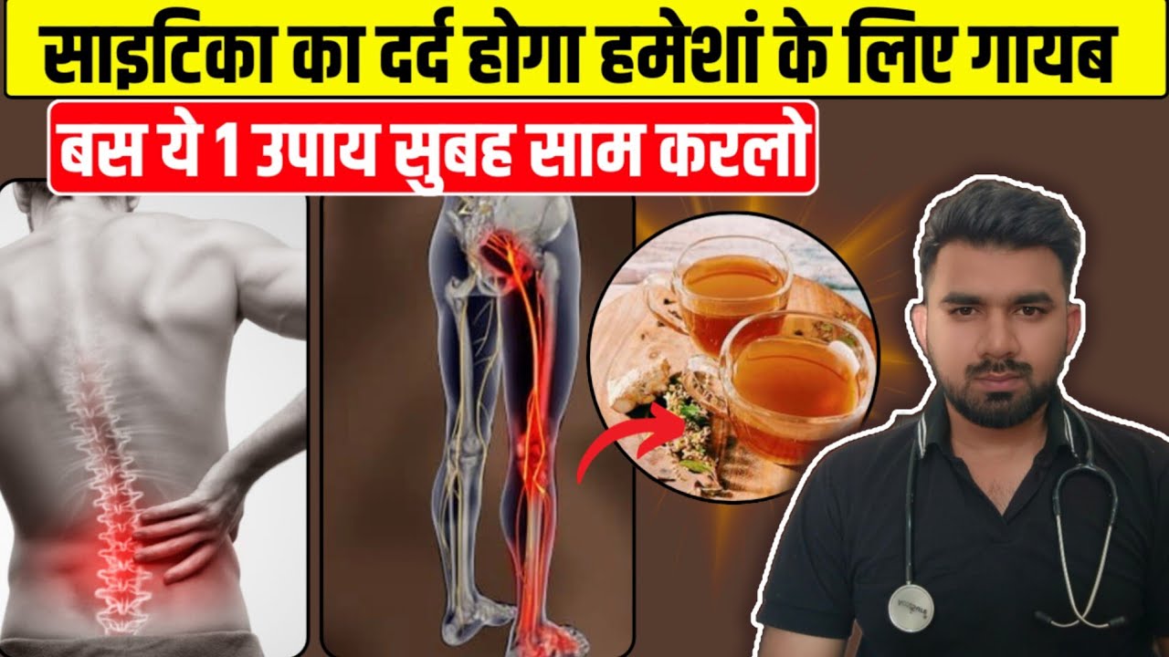 Sciatica Pain क्या है? कारण और 1 Powerful घरेलू उपाय | Slip Disc & Nerve Pain Relief