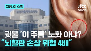 Download lagu 노화인 줄 알았더니 '이 징후'…귓불 주름, AI로 식별해 보니｜지금 이 쇼츠