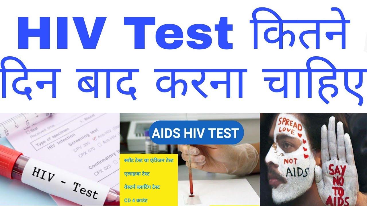 hiv test kitne din baad karna chahiye Hiv/Aids Test किसको कराना चाहिए