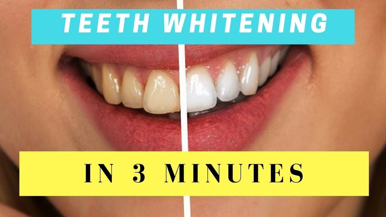 How To Whiten Your Teeth At Home in just 3 minutes How Simple Remedies YouTube