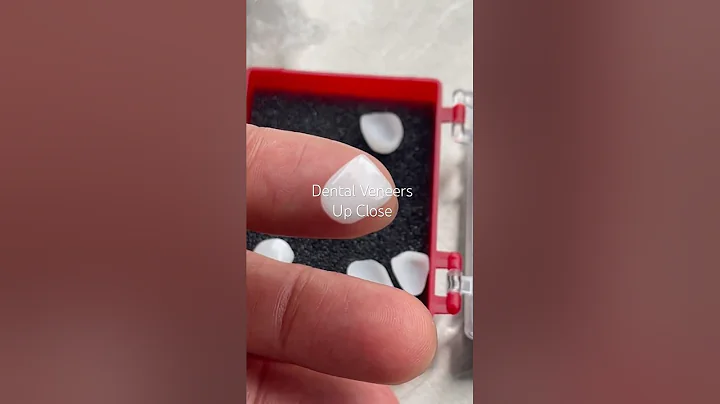 Dental veneers up close #veneers #austintx #porcelainveneers #cosmeticdentistry #shorts #teeth