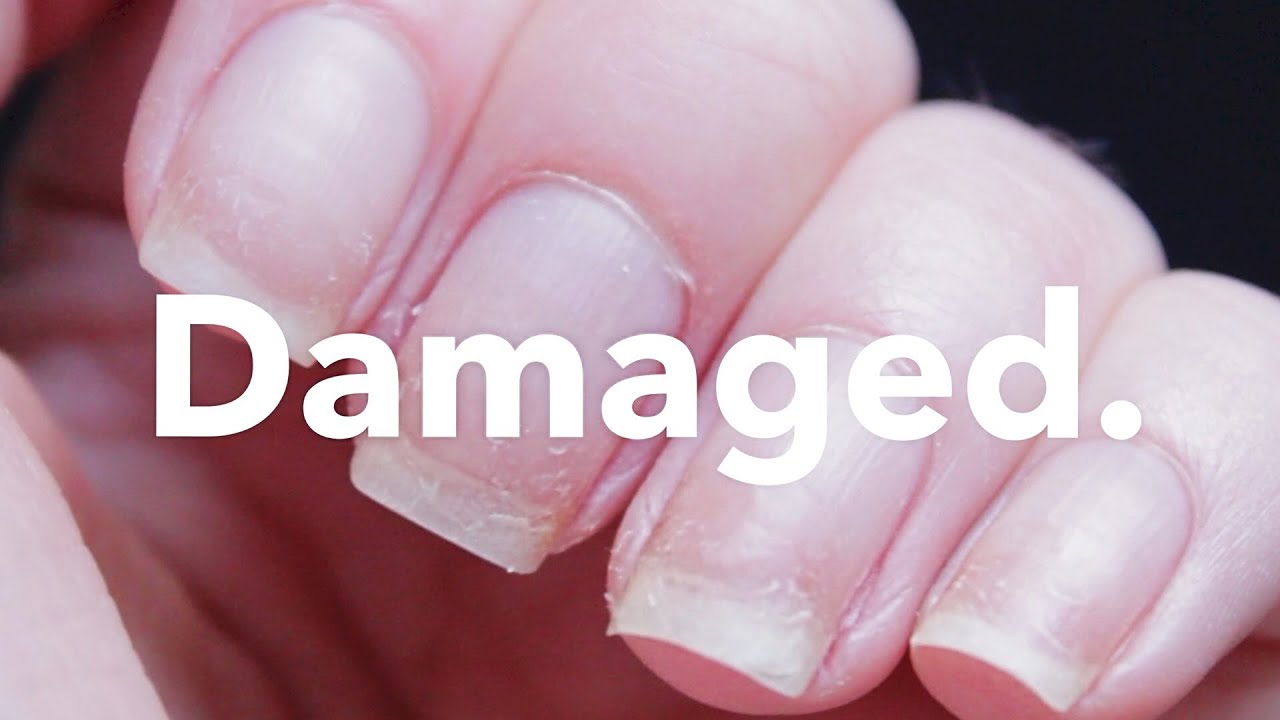 Отращивание поврежденных ногтей за 30 дней.