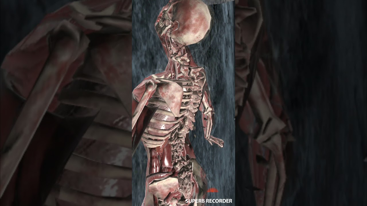 AWESOME XRAYS PT.3 MKX MOBILE