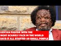KENYAN PASTOR WITH THE MOST SCARELY FACE IN THE WORLD SAYS IT ALL STARTED AS SMALL PIMPLE