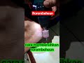 membersihkan tumit pecah-pecah
