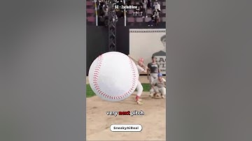 😱 She Got Hit by TWO Foul Balls in One Game — Unluckiest Fan Ever?! ⚾💥