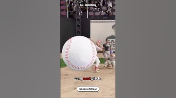 😱 She Got Hit by TWO Foul Balls in One Game — Unluckiest Fan Ever?! ⚾💥