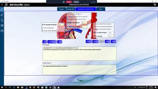 Renovascular Dopplar screenshot 5