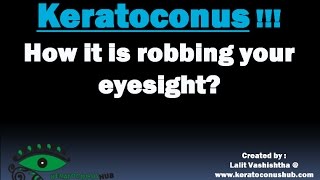HOW KERATOCONUS IS ROBBING YOUR EYESIGHT !!! [HD]
