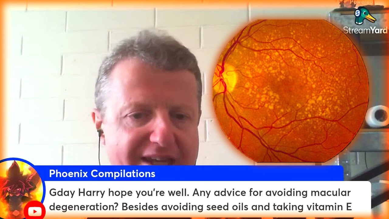 How to avoid macular degeneration HarrySerpanos YouTube