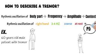 Download Lagu Tremor syndromes (All you need to know about tremor types, examination and treatment) MP3