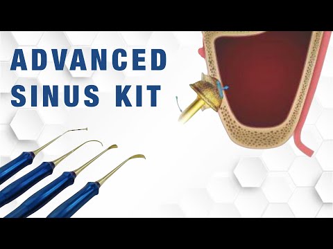 DASK - Dentium Advanced Sinus Kit (tutorial)