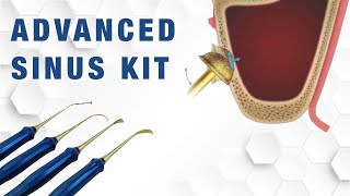 DASK  Dentium Advanced Sinus Kit (tutorial)