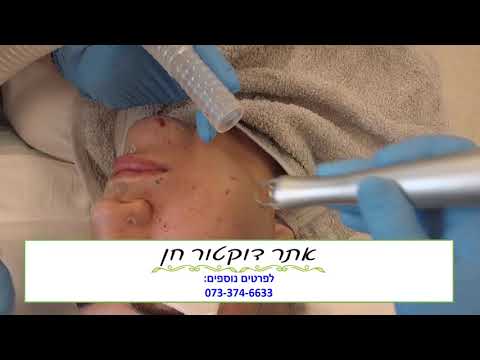 וִידֵאוֹ: שריל שו: דוגמנית עם 300 שומות על הגוף